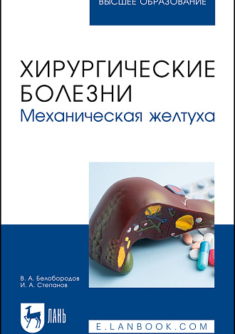 Хирургические болезни. Механическая желтуха, Белобородов В. А., Степанов И. А., Издательство Лань.