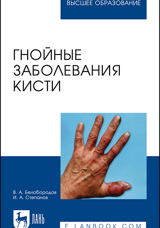 Гнойные заболевания кисти, Белобородов В. А., Степанов И. А., Издательство Лань.